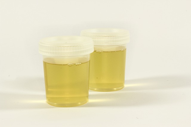 Don't let legal problems come from false positive on CBD and THC urine test